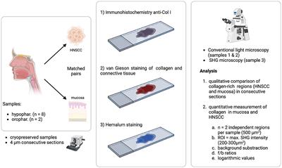 Second harmonic generation imaging of head and neck squamous cell carcinoma